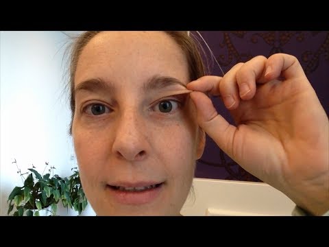 Augenlidstraffung ohne OP - Vor der Behandlung (besser als Plasma Pen!) Erfahrungen