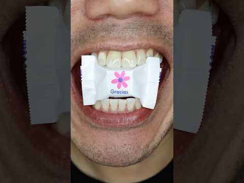 Gracias 🌸| Ritter SPORT Cubes Thank You Chocolate 🍫 #DoctorTristanPeh #ASMR #shorts