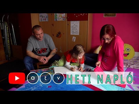 látás néma pásztor látás csak az oldalakon