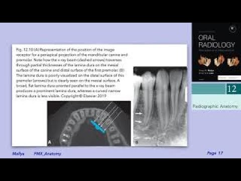 Anatomic radiology of maxilla