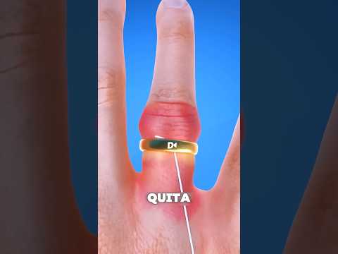 Cómo quitar un anillo atascado en segundos 😳 #shortvideo