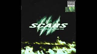 Caleb Cruise ~ Scars (feat. TYuS)