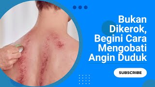 Download lagu Nyeri Dada karena Masuk Angin Bolehkah Dikerok? #kerokan #nyeridada  #angina mp3