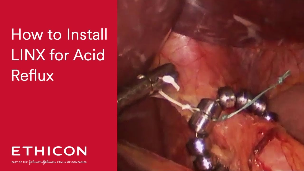 Pablo Marín Pérez-6