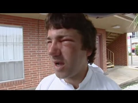 Deadly Killer Bee Attack | Ultimate Killers | BBC Earth