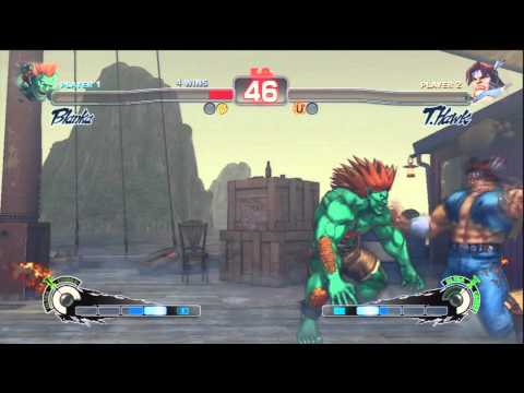 Beyond Technical - Episode 7: Matches With Doug