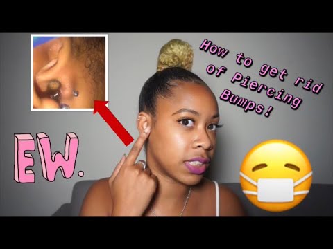 HOW TO GET RID OF PIERCING BUMPS (FAST!!)