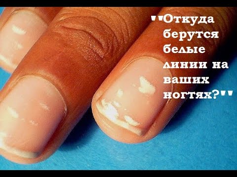 Весело о веснушках Вальс при веснушках
