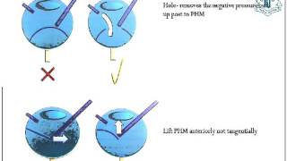 Video of Code Red in AIOC 2015