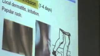 Dr Azza 3 29 10 2014   YouTube