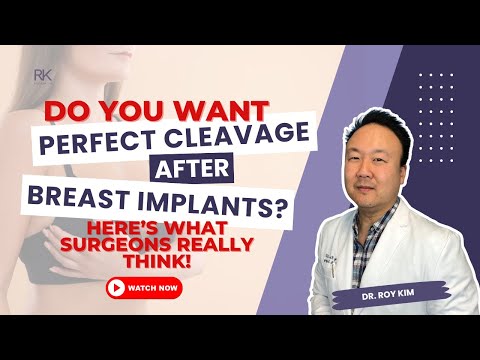Want Perfect Cleavage After Implants? Here's What Surgeons Really Think! | Dr. Roy Kim