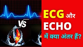 Download lagu ECG vs ECHO Difference in Hindi | Heart Electrocardiograph vs Echo-cardiogram mp3 Download lagu ECG vs ECHO Difference in Hindi | Heart Electrocardiograph vs Echo-cardiogram mp3