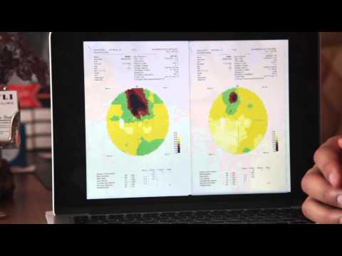 Enfermedad de Stargardt Tratamiento - Stargardt Disease Treatment - FIRATLI CLINIC - part 2