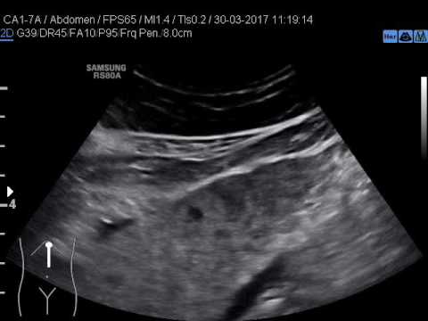 Colonna vertebrale umana immagine Neck Rutti osteocondrosi air