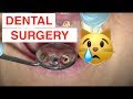 Dental Surgery