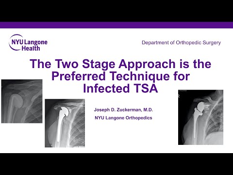 The Two Stage Approach is the Preferred Technique for Infected TSA