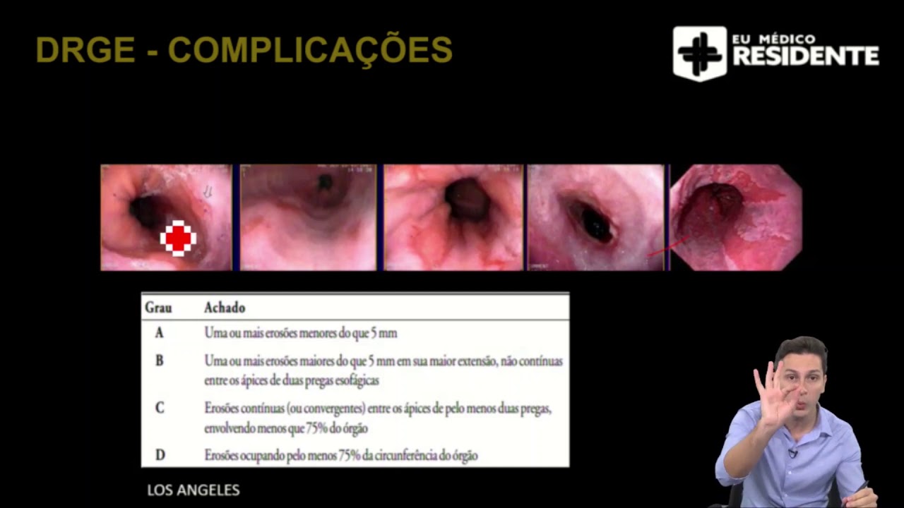 DRGE para Residência Médica