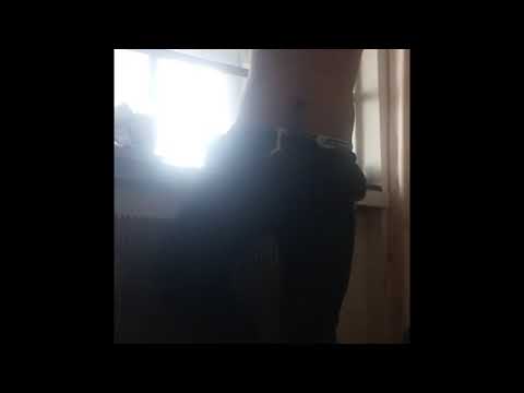 Armless Asian Amputee Man Showing Stumps To Female Devotee- Double Arm Amputee- No Arms Asian Guy