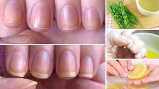 How to Grow Nails Faster &amp; Stronger: 7 Best Home Remedies