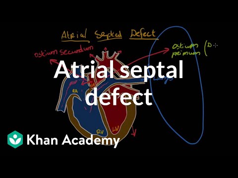Atrial septal defect | Circulatory System and Disease | NCLEX-RN | Khan Academy