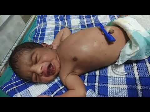 What are these movement?