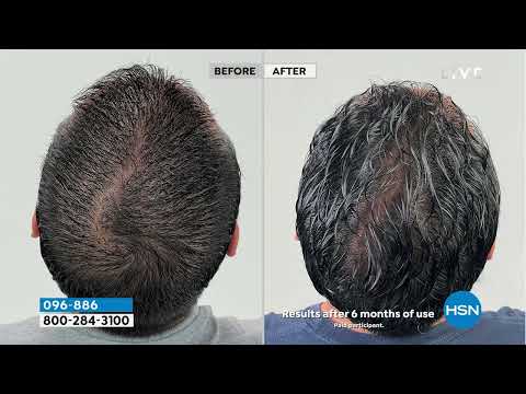 Capillus82 Hair Regrowth Laser Therapy Cap with Activator