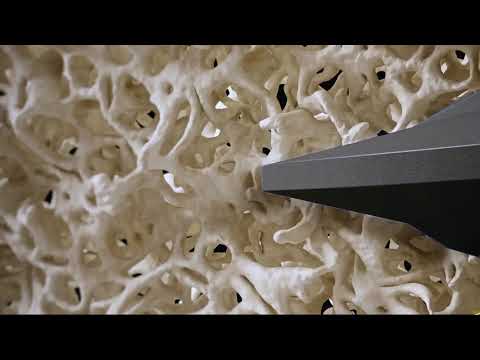 Straumann® BLX Implant System - Thread Designs Dynamic Bone Management
