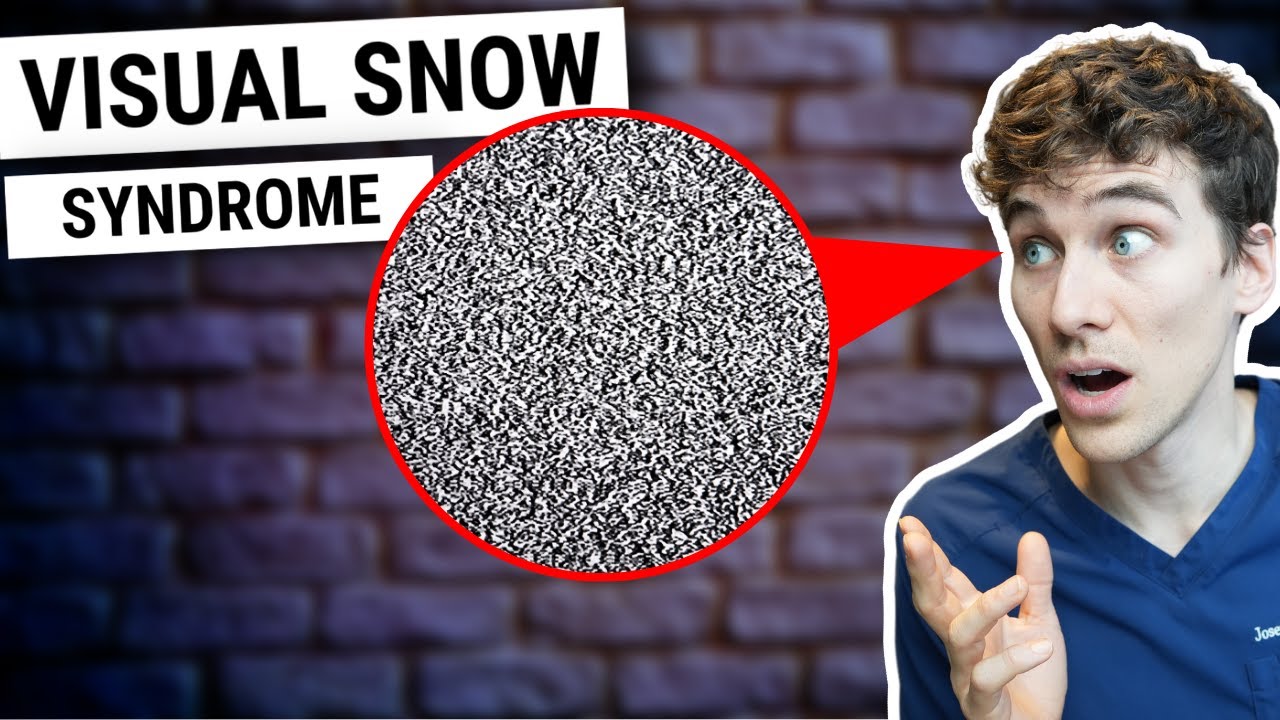 How rare is visual snow syndrome? Archive EN