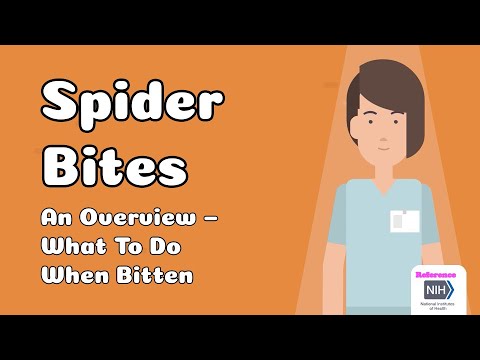Spider Bites  - An Overview – What To Do When Bitten
