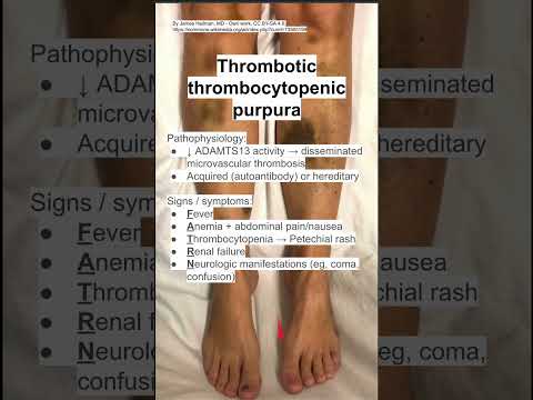 Thrombotic thrombocytopenic purpura (TTP)