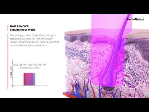 Quanta System  - Thunder