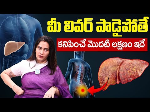 10 Symptoms of Liver Problem | Fatty Liver Symptoms | liver damage Sign | Dr. Kavya | iDream Health