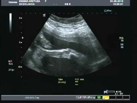 Adryan Lucas Dorneles