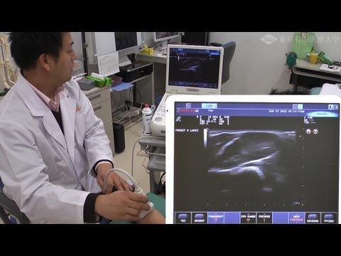 柔道整復師による超音波画像観察装置の活用
