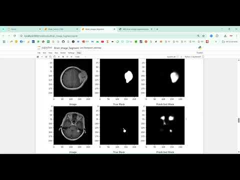 MRI Brain Image Segmentation using CNN in Python Projects
