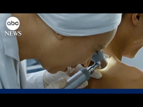 How to protect against melanoma