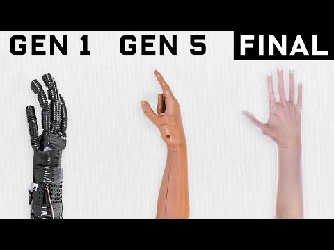 The Evolution of Prosthetic Arms - Fascinating!