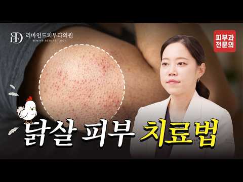 닭살 피부, 없앨 수 있다고? 피부가 오돌토돌했던 진짜 이유! 🐔