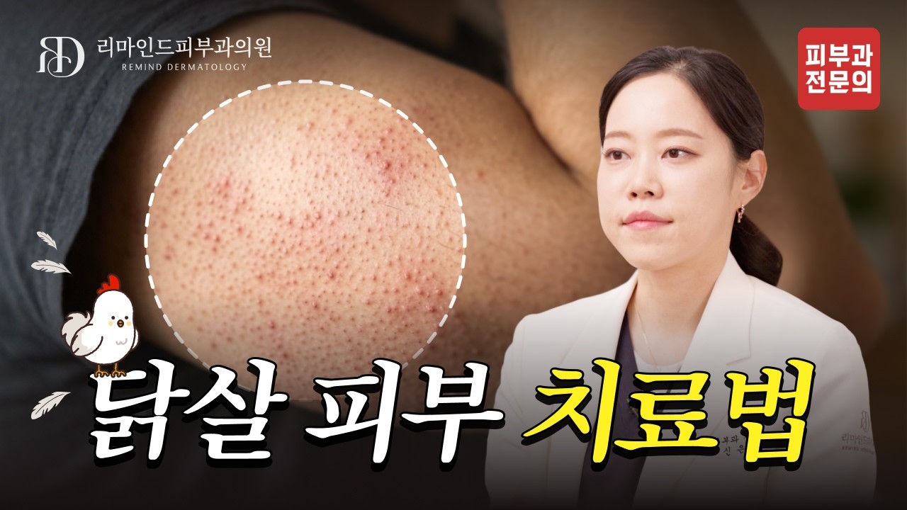 닭살 피부, 없앨 수 있다고? 피부가 오돌토돌했던 진짜 이유! 🐔