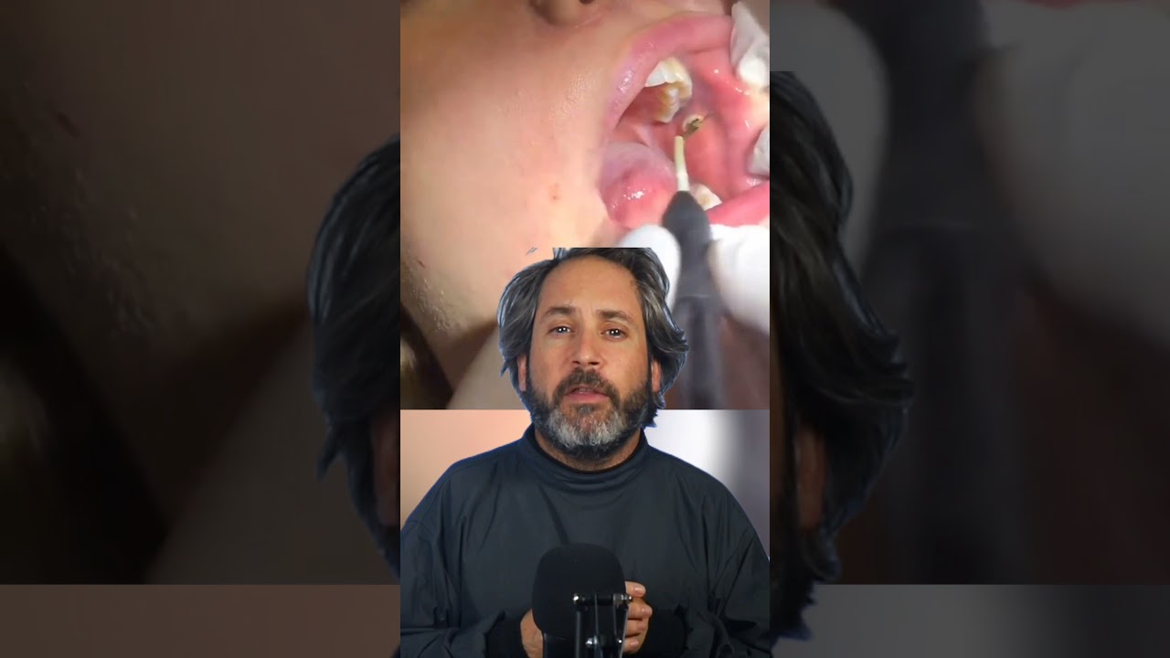 Watch Cómo ADELGAZAR la CARA REDONDA 🤩 La operación de MUCHOS FAMOSOS que NO TE IMAGINAS cómo se hace Now Cómo ADELGAZAR la CARA REDONDA 🤩 La operación de MUCHOS FAMOSOS que NO TE IMAGINAS cómo se hace