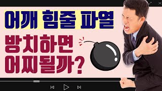 회전근개 파열, 무조건 수술해서는 안되지만 수술이 꼭 필요한 파열도 있습니다!