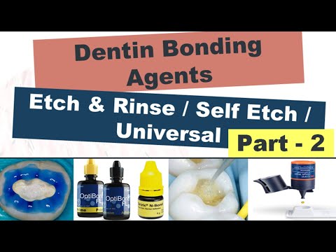 Dentin Bonding Agents (Etch & Rinse / Self Etch / Universal Adhesives) - Which one is the BEST???