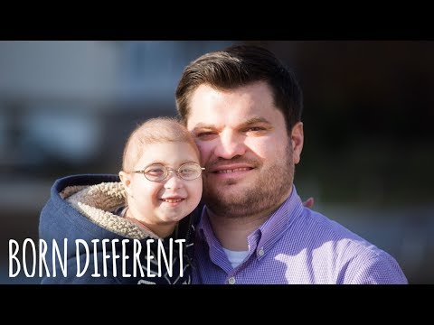 My Rare Dwarfism Makes Me 1 in 4 Million | BORN DIFFERENT