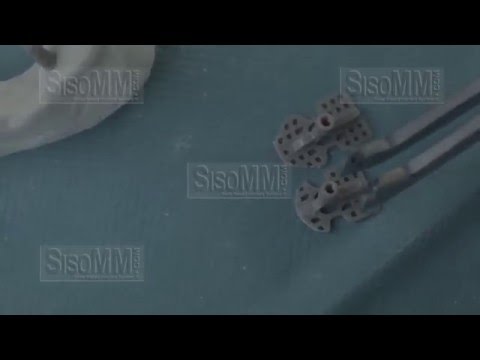 Procedure to implant B001   Bd