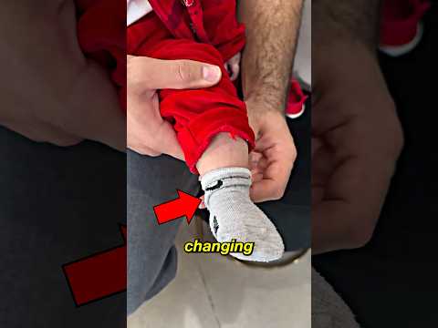 The Cutest Rare Condition Ever #shorts