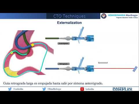 Externalization
