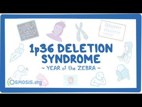 Canavan disease Year of the Zebra
