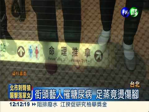 足蒸反燙傷 街頭藝人獲賠90萬