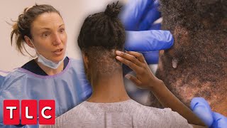 Dr. Emma Treats Jelani&#39;s Mysterious Pus-Filled Bumps | Save My Skin