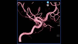 動画のサムネイル
